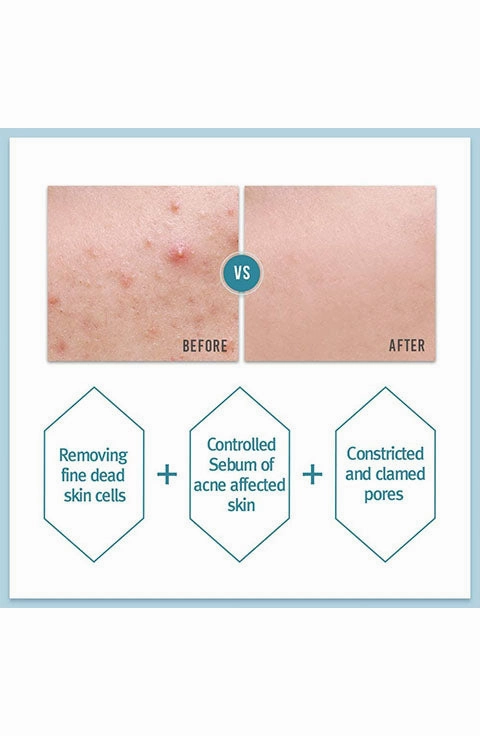 [Pyunkang Yul] Acne Toner (150mL)