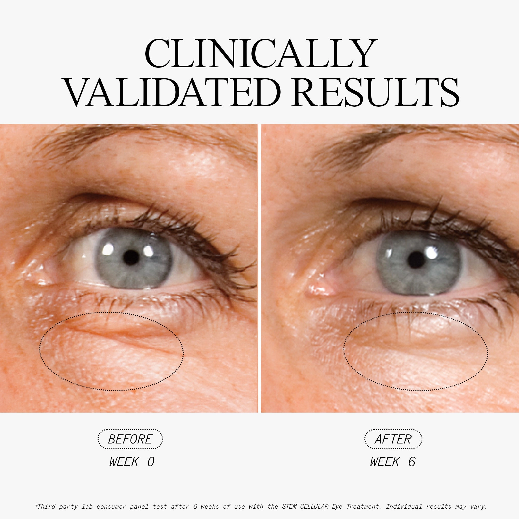 Anti-Wrinkle Cellular Routine