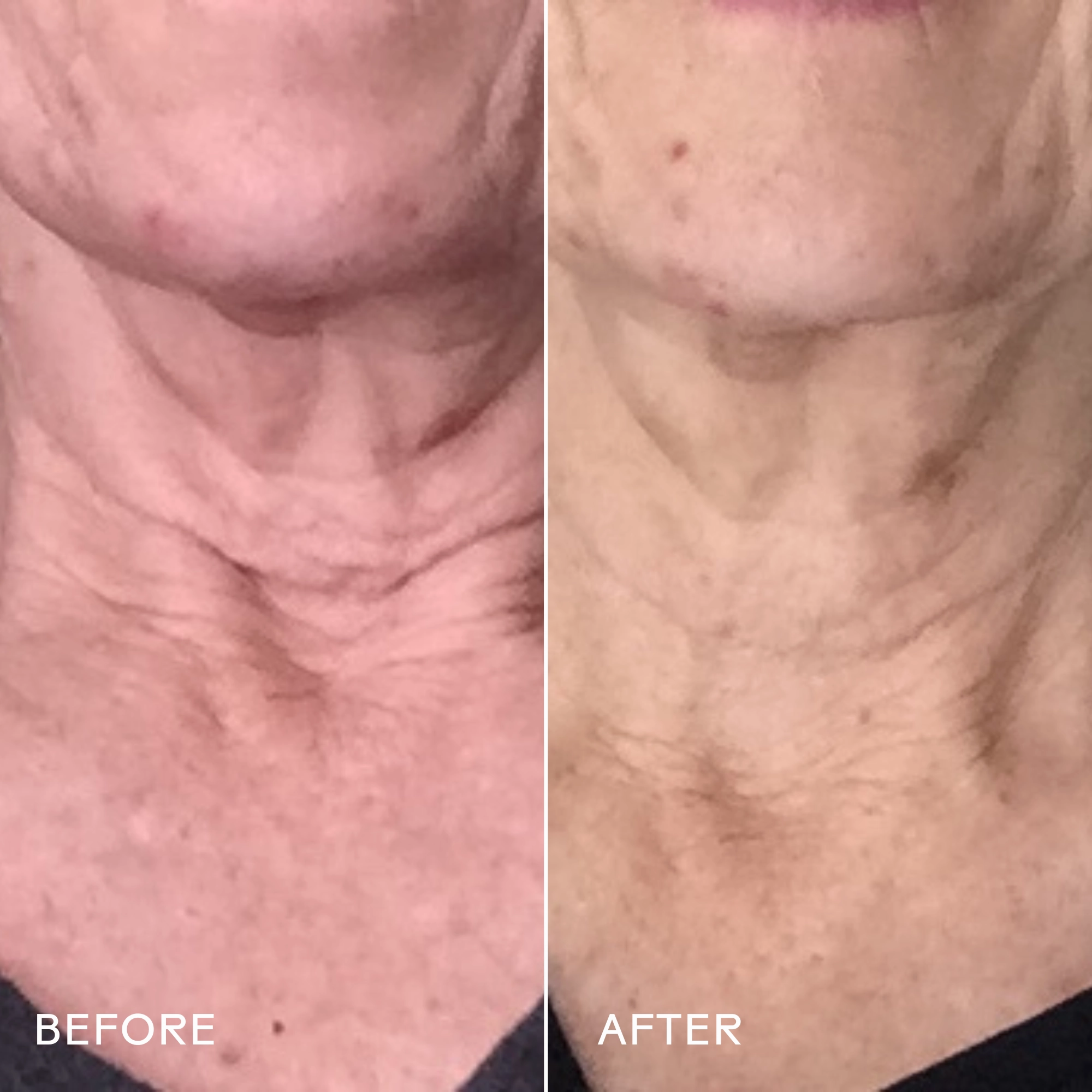 Firm Believer Goji Stem Cell   Pomegranate Smoothing Neck   Face Cream