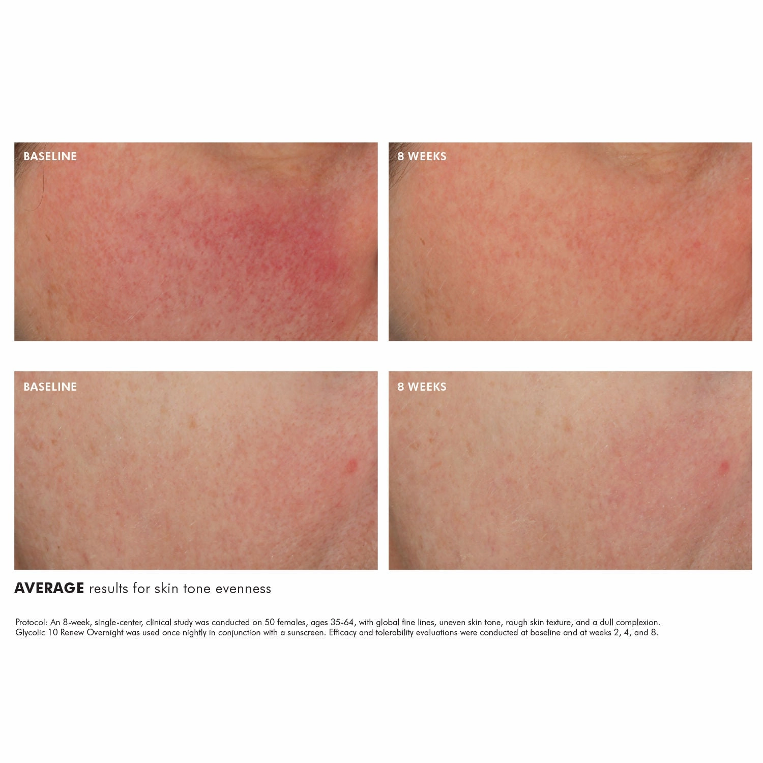 Glycolic 10 Renew Overnight