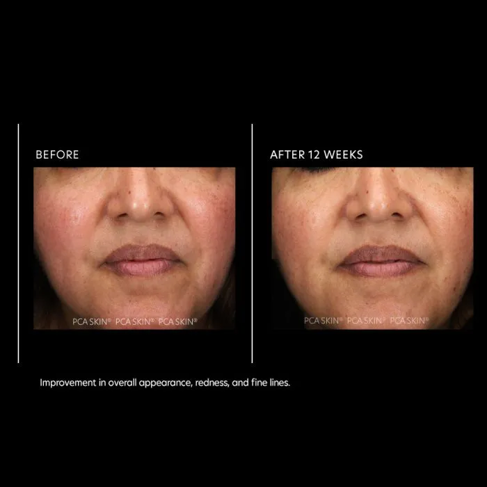 PCA Skin Resurfacing Serum