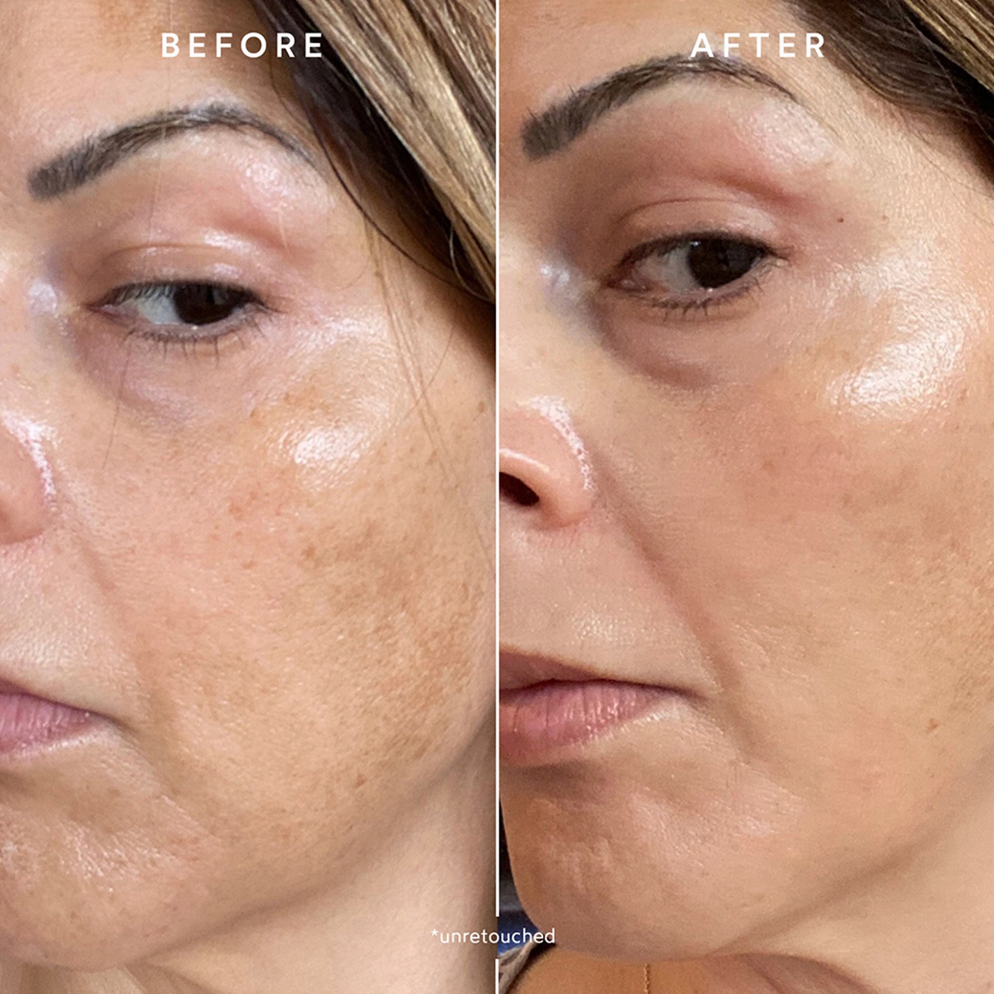 Phyto-Retinol Vitamin A Booster