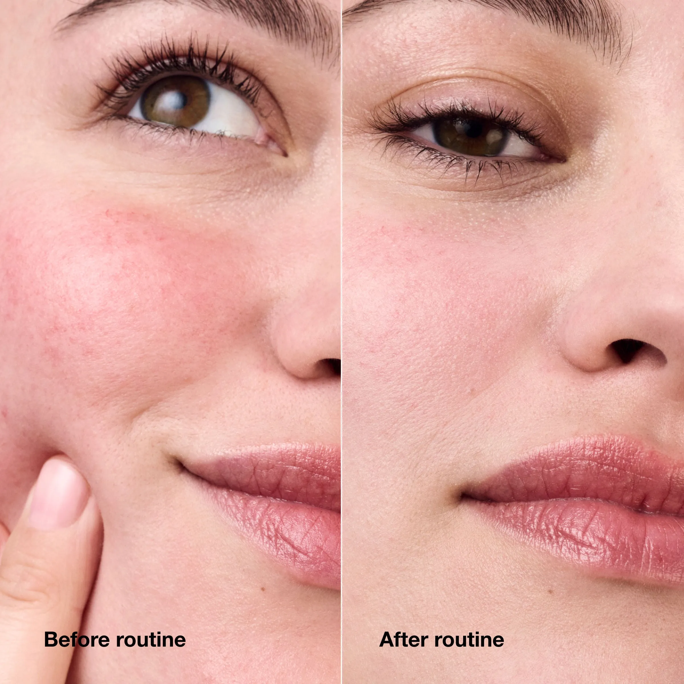 Redness Solutions Daily Relief Cream With Probiotic Technology