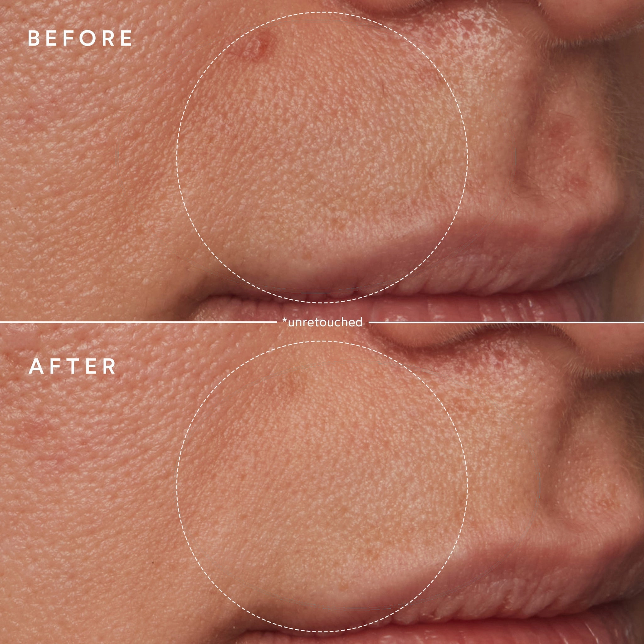 Renew Microbiome Enzyme Essence