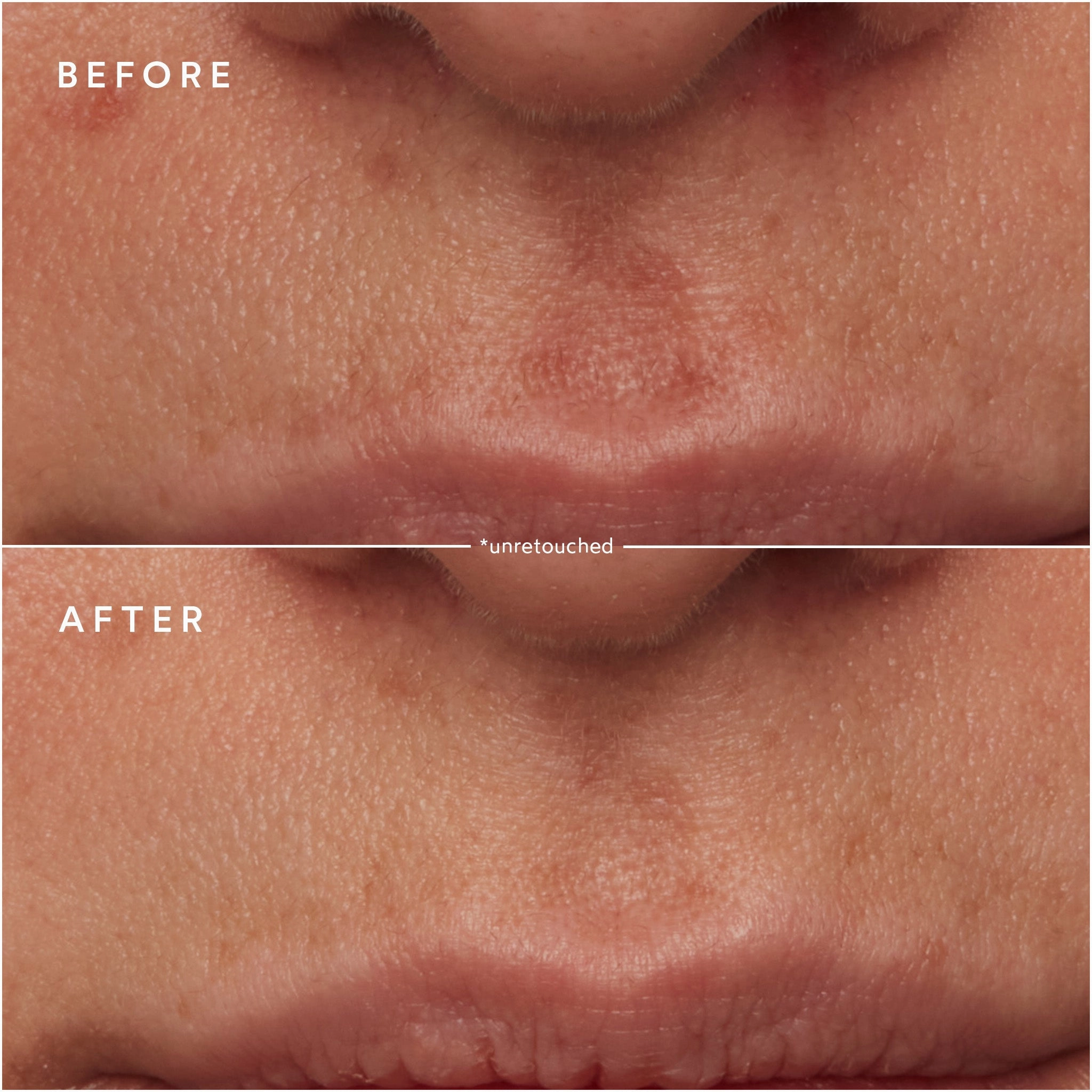 Renew Microbiome Enzyme Essence