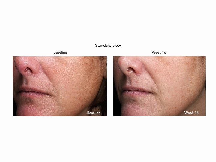 Sente Pigment & Tone Correcting Mask