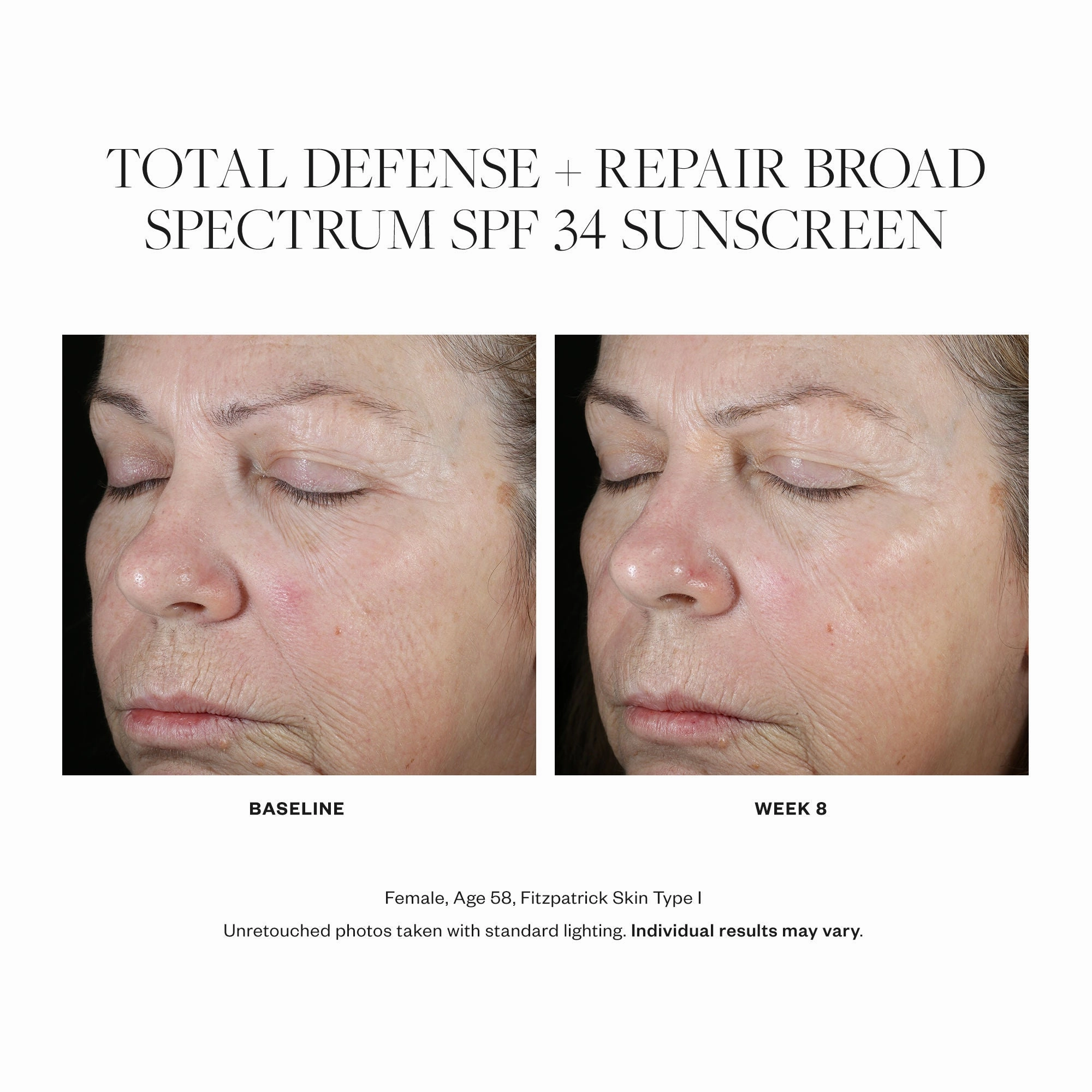 Total Defense   Repair Broad Spectrum SPF 34 Sunscreen