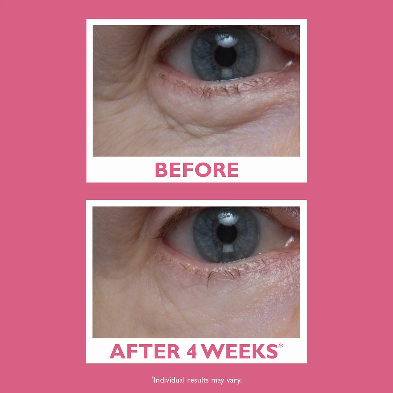 Vital-E Microbiome Age Defense Eye Cream